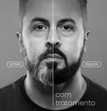 Camuflagem de barba 