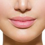 Aesthetic - UltraCel - Bigode Chinês (sulco nasogeniano) - 1 SESSÃO