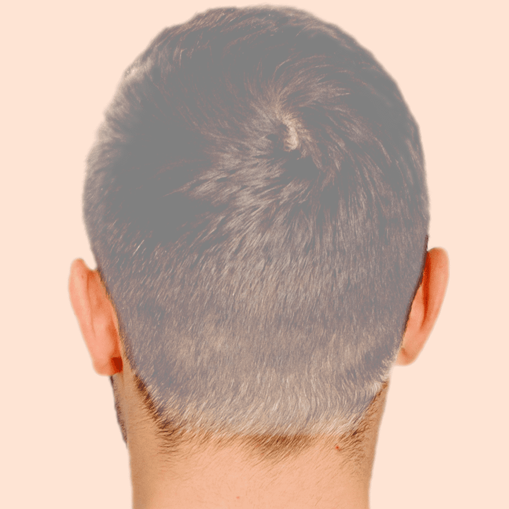 Depil - Cabeça