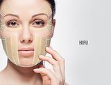 H.I.F.U Rejuvenescimento Facial