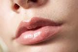 Aesthetic - Lip Glow