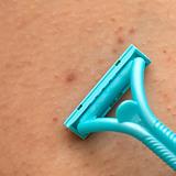 Aesthetic - Foliculite