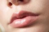 Aesthetic - Lip Glow