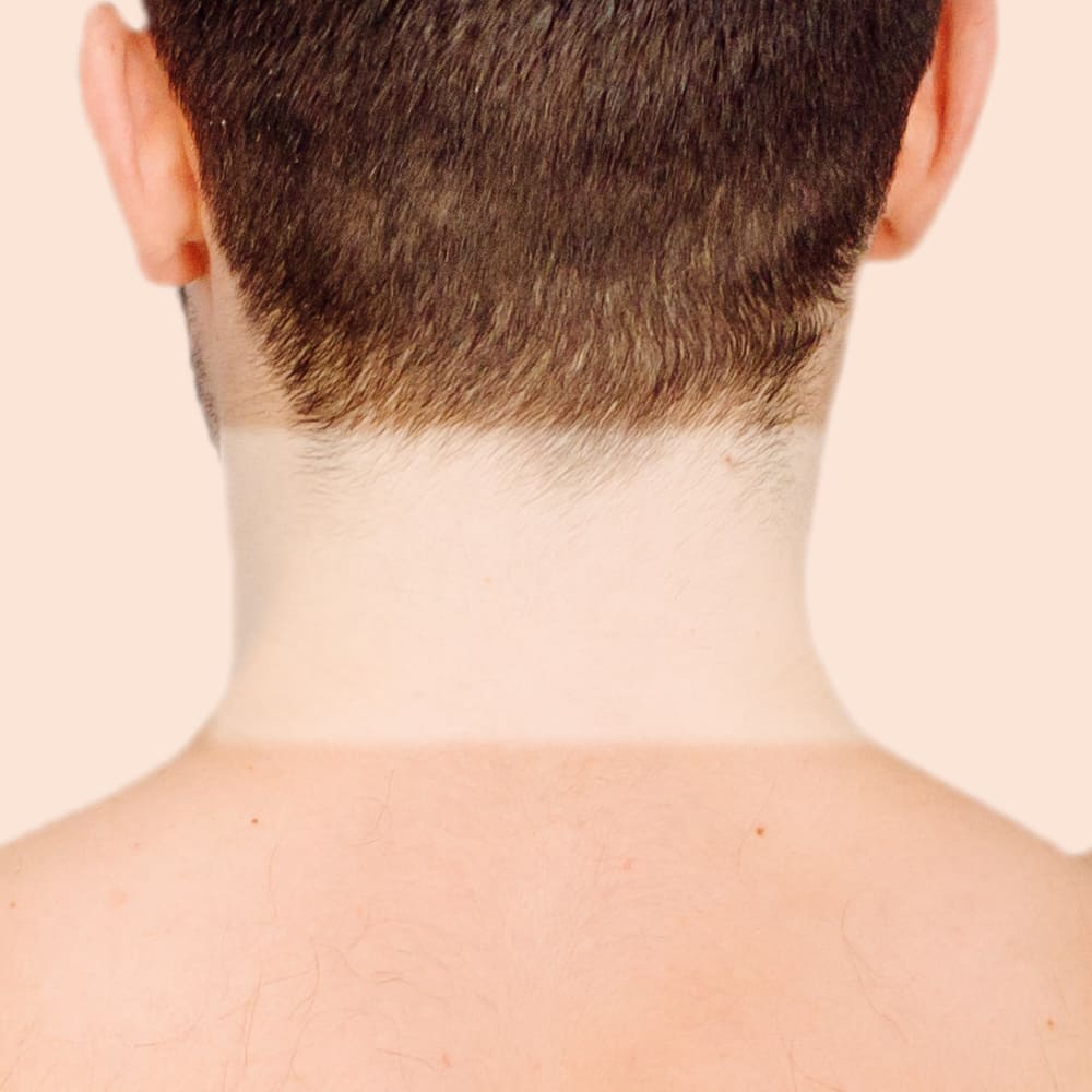 Depil - Nuca