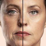 Aesthetic - Rejuvenescimento Facial 4D