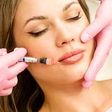 Preenchimento labial