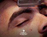 Limpeza da sobrancelha