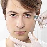 Microagulhamento - 1 Sessão