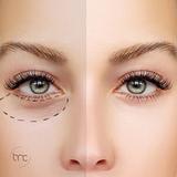 Clary Max - Peeling de olheiras