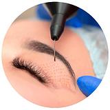 Blefaroplastia sem cortes