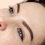 Aesthetic - Micropigmentação (remoção)