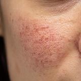 Aesthetic - Rosáceas