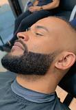 Barba Pigmentada