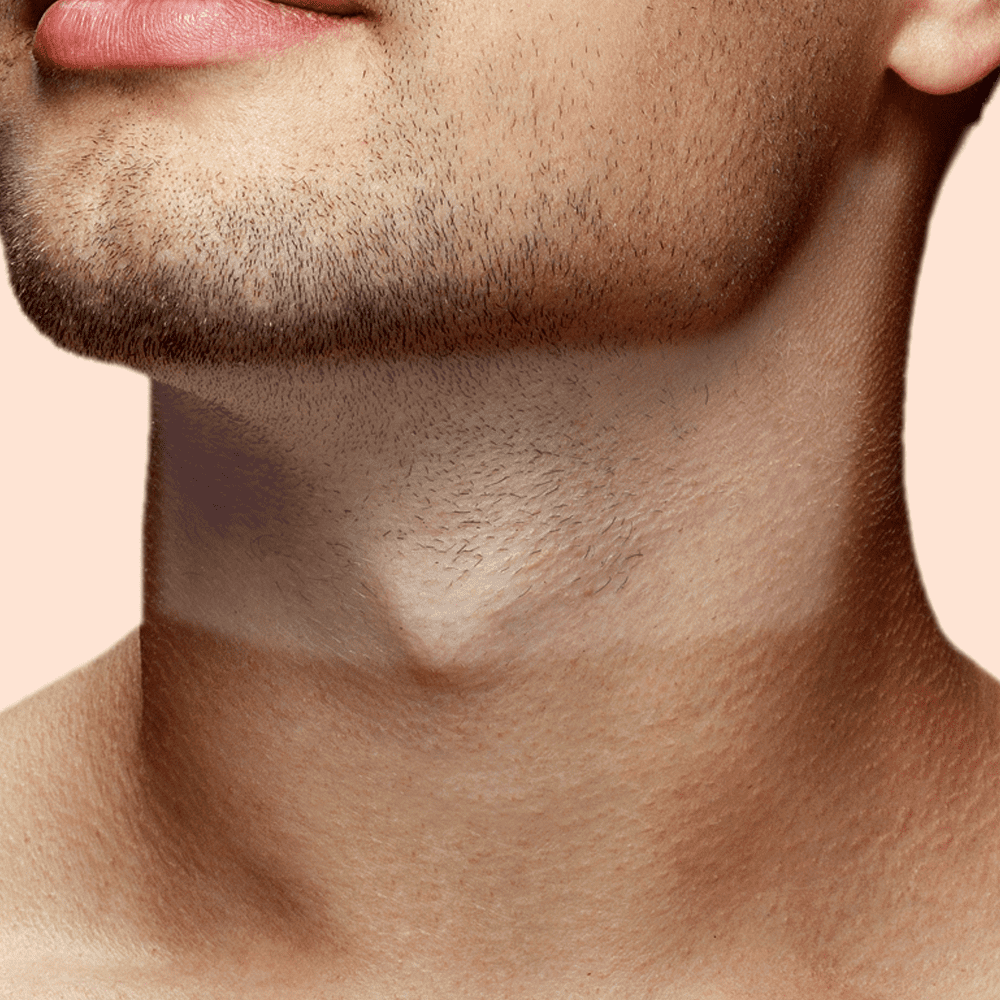 Depil - Faixa de Barba