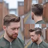 {Z}     ACABAMENTO (pezinho) 