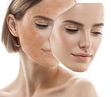 Aesthetic - BB Glow Laser&Co